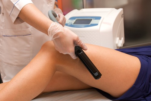 epilation au laser